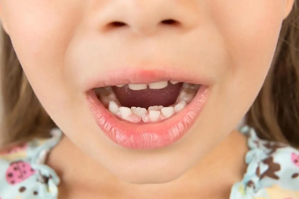 a que edad cambian los dientes de leche los niños - Por qué se caen los dientes a los 4 años